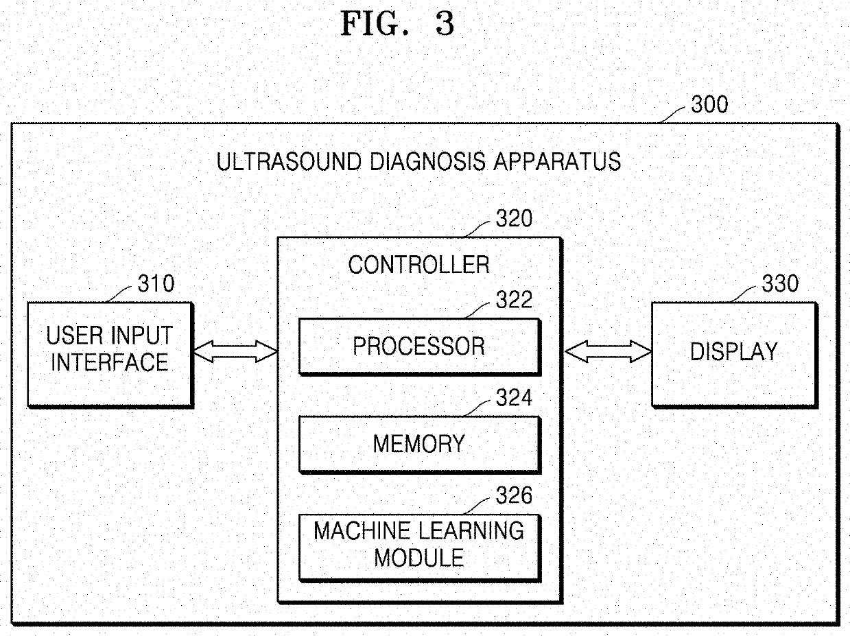 Ultrasound diagnosis apparatus for determining abnormality of fetal heart, and operating method thereof