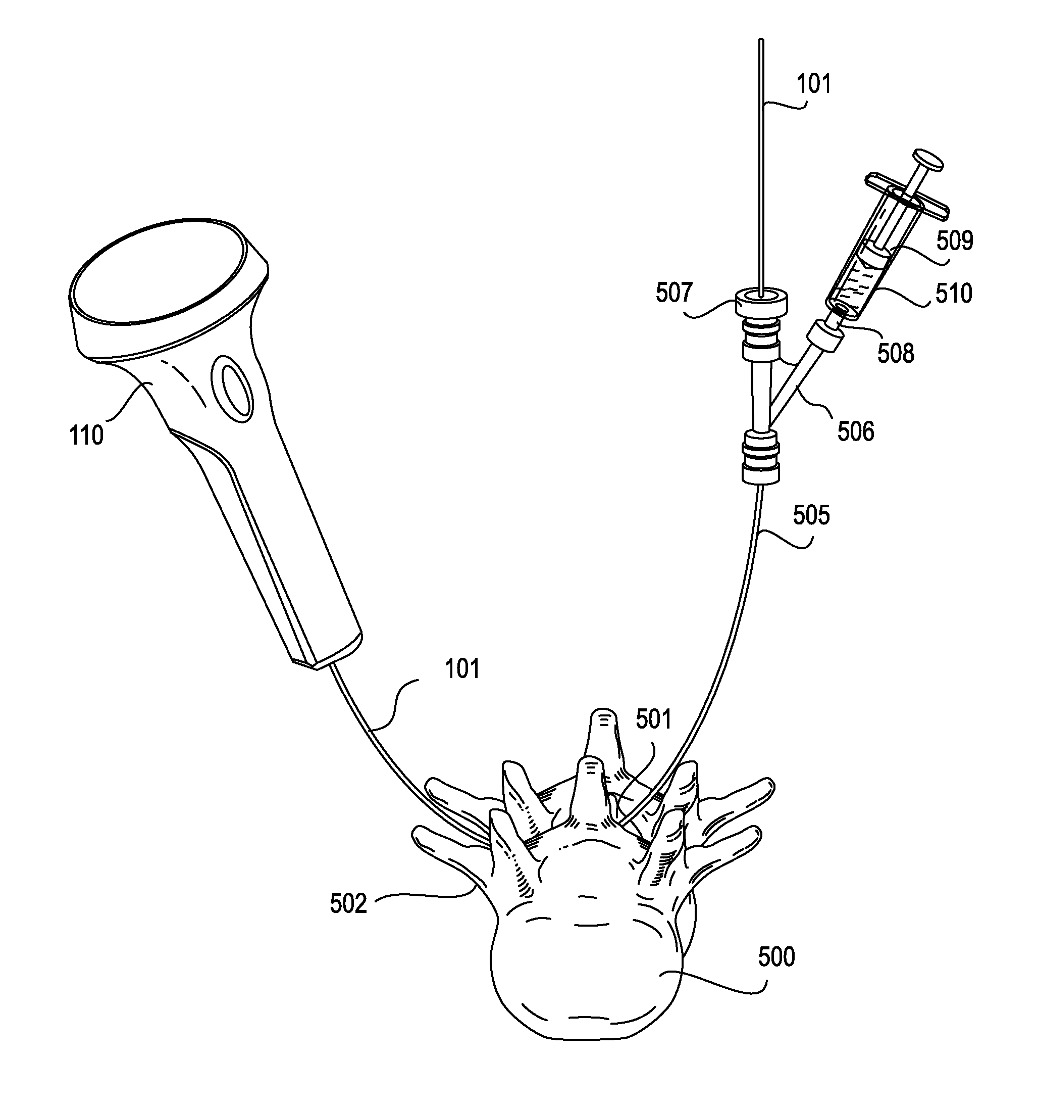 Devices and methods for treating tissue