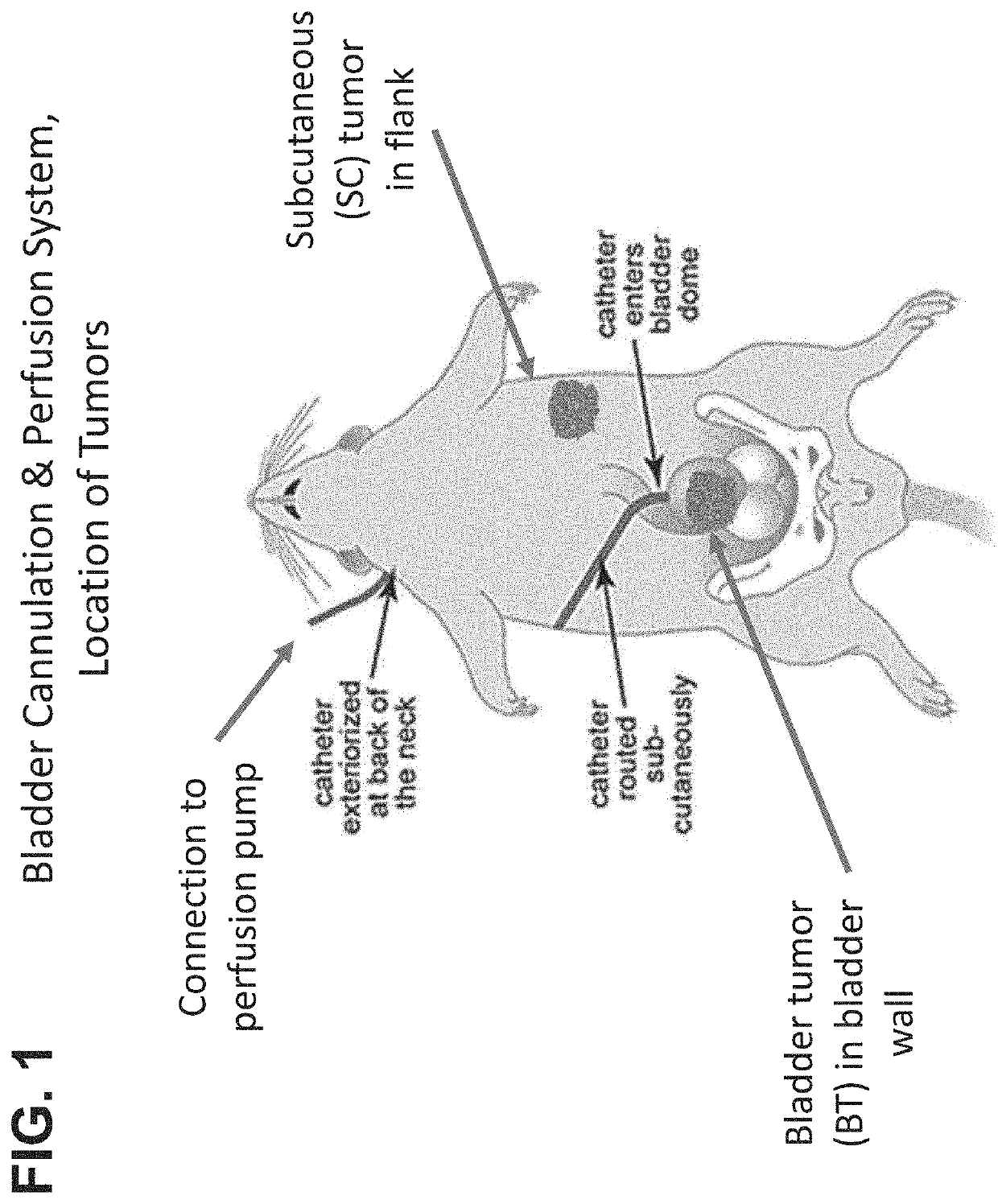 Methods of treating tumor metastasis