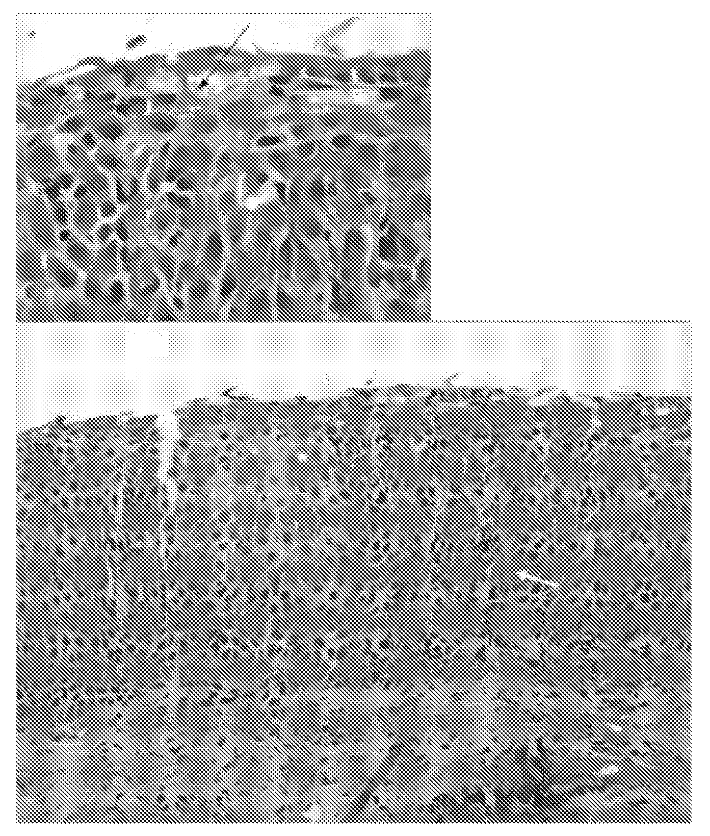 Topical corticosteroids for the treatment of inflammatory diseases of the gastrointestinal tract