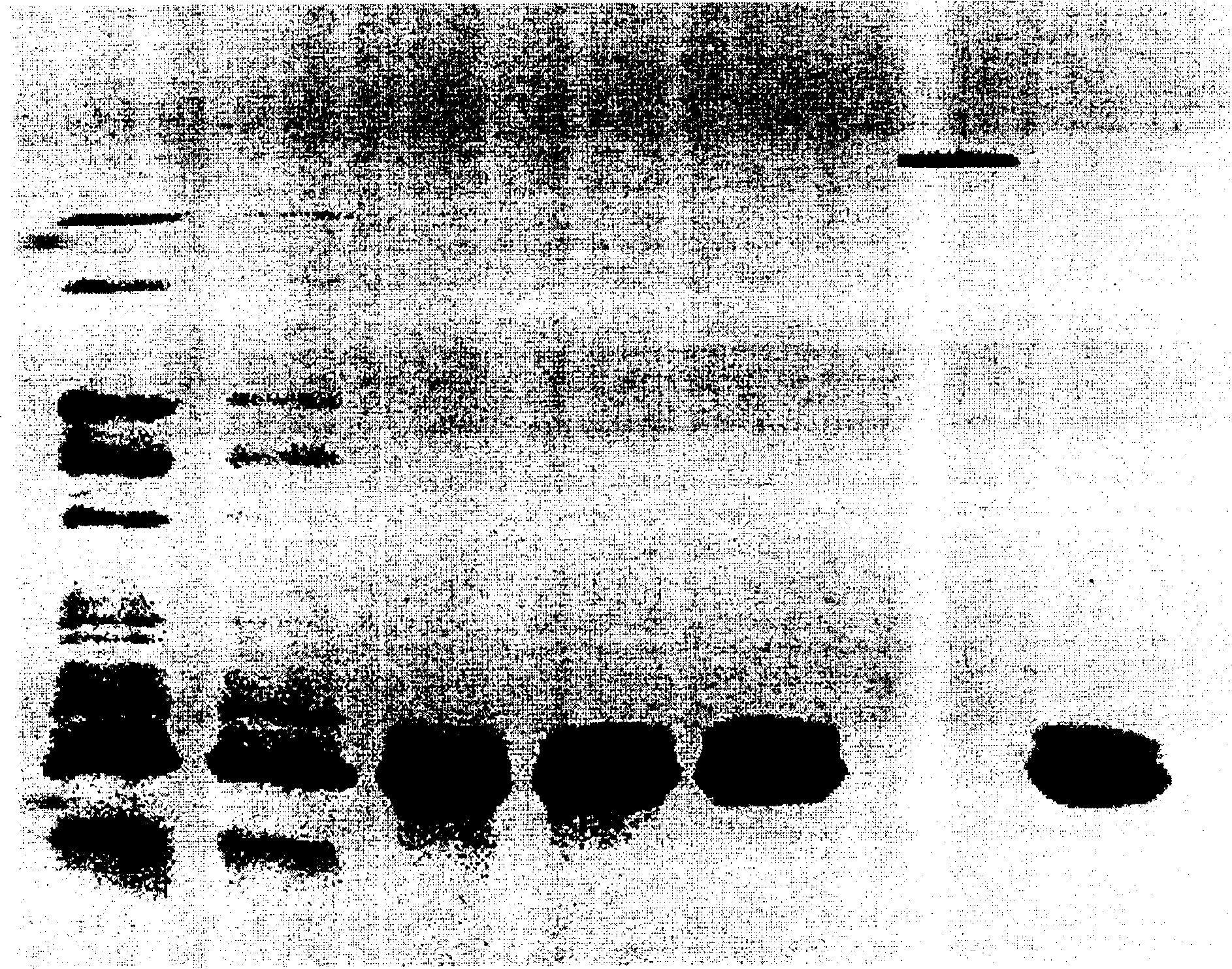 Purification method of recombinant yeast strain and rhGM-CSF to express human granulocyte-macrophage colony stimulating factor