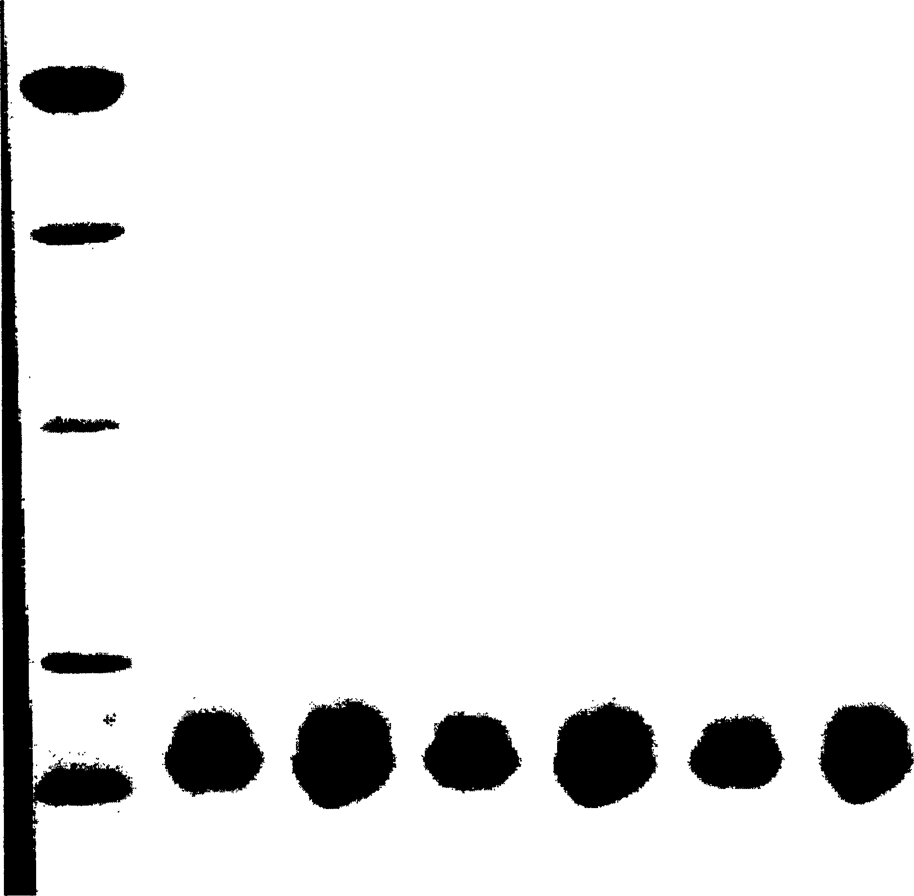 Purification method of recombinant yeast strain and rhGM-CSF to express human granulocyte-macrophage colony stimulating factor