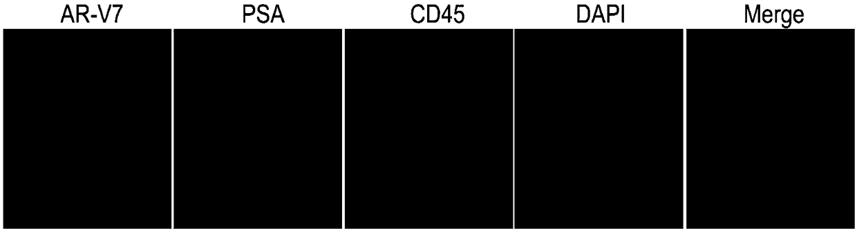 Immunofluorescence kit for detecting human prostate cancer antigens PSA and AR-V7 and application