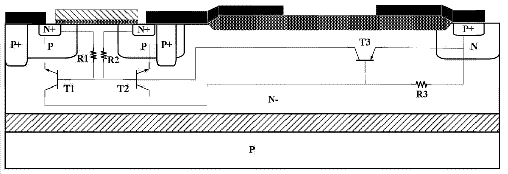 SOI-LIGBT (Silicon on Insulator-Lateral Insulated-Gate Bipolar Transistor) device based on double channel structure