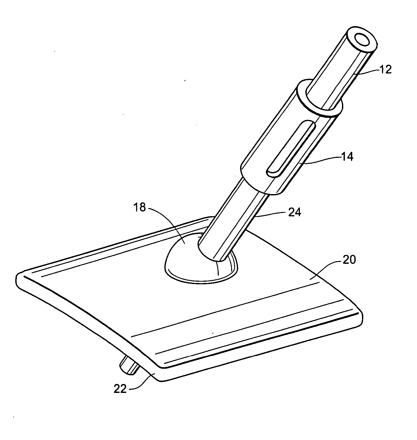 Anchorless non-invasive force dissipation system for orthopedic instrumentation