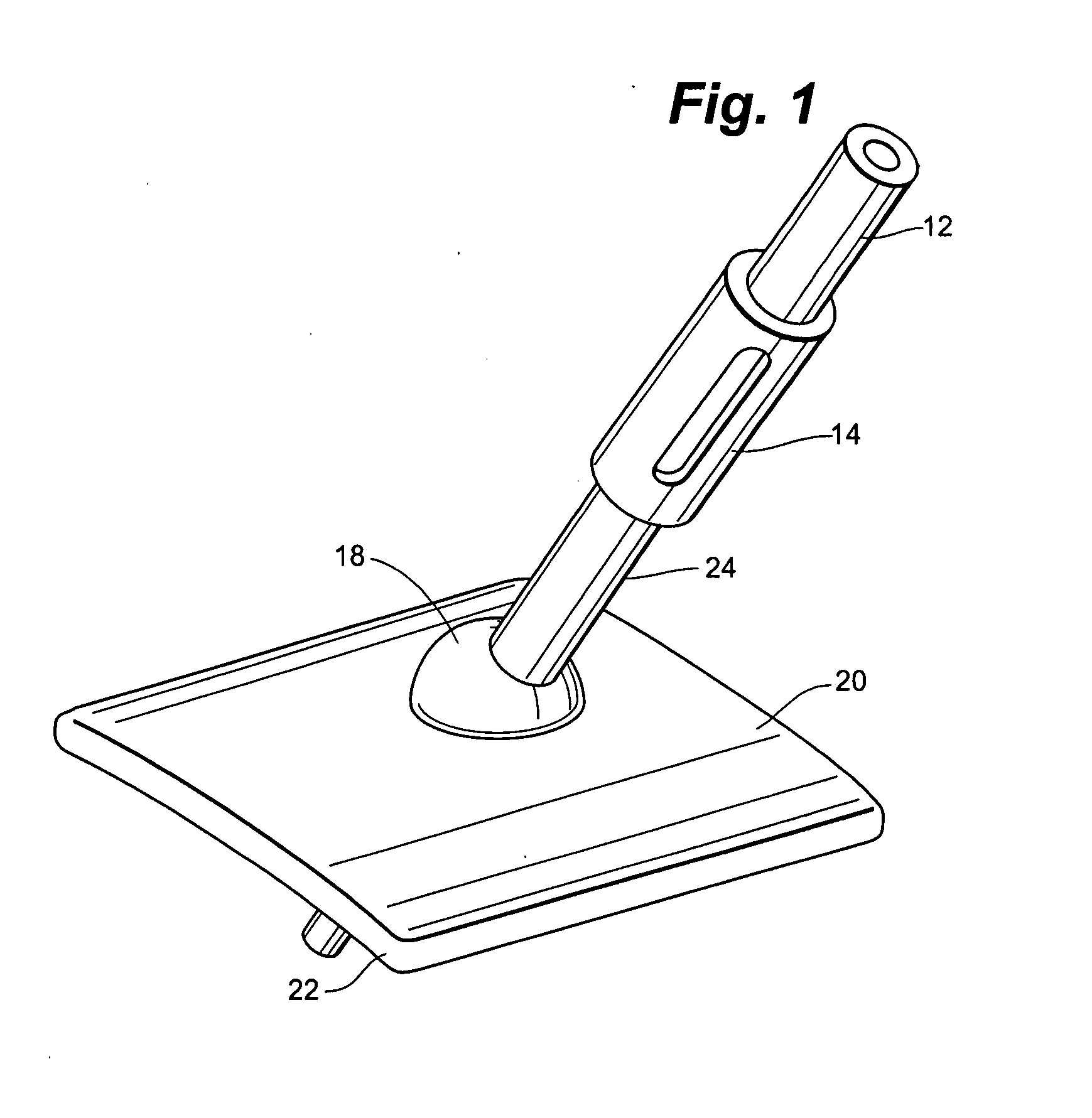 Anchorless non-invasive force dissipation system for orthopedic instrumentation