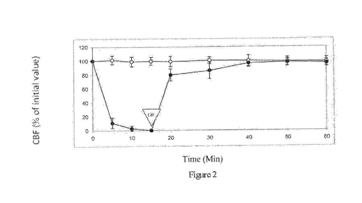 Methods for treating Parkinson's disease