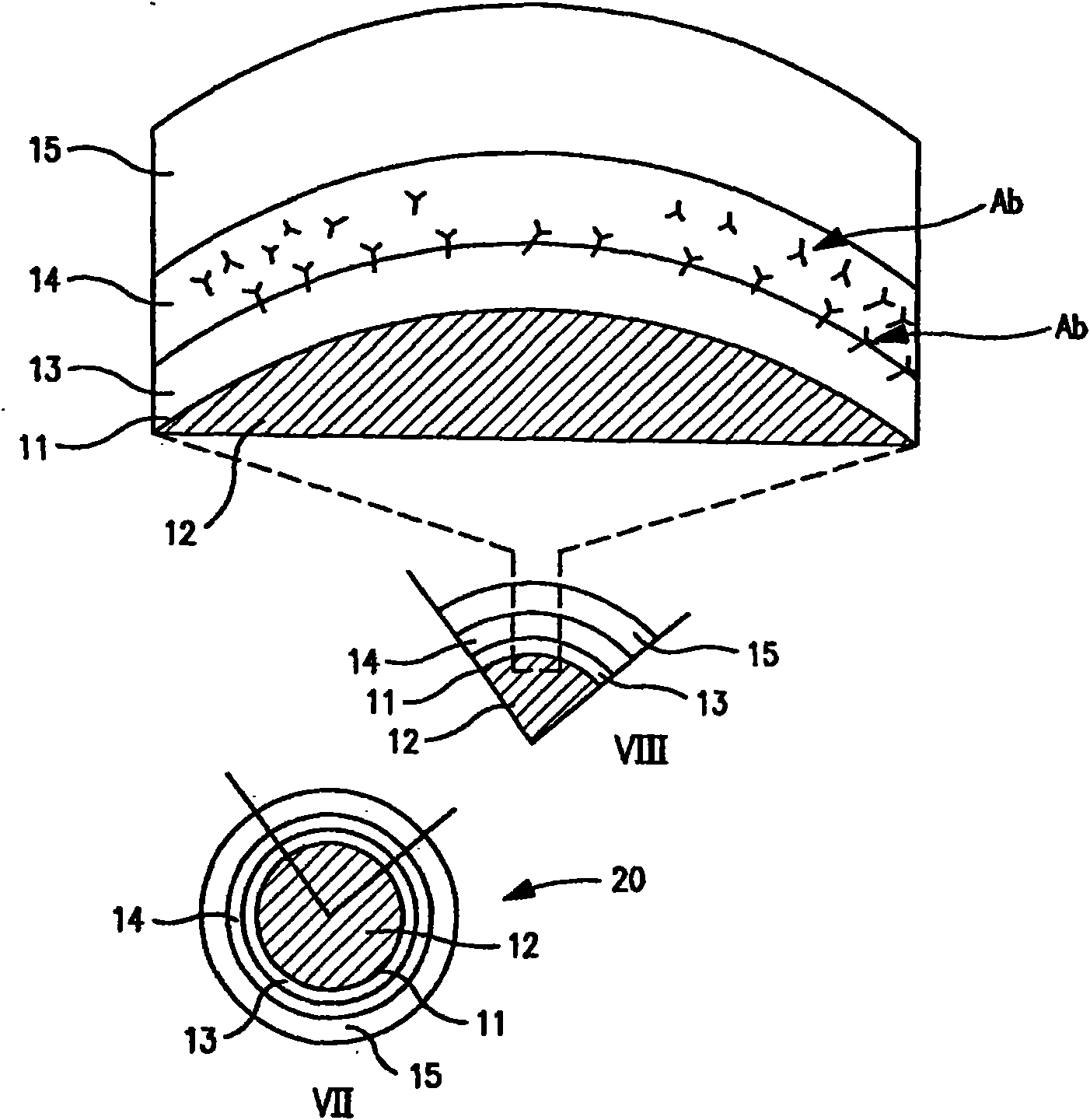 Multiple drug-eluting coronary artery stent for percutaneous coronary artery intervention