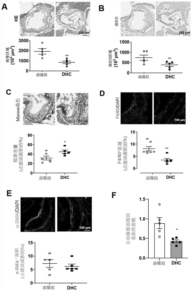 Application of DHC (dehydrocorydaline) in preparation of preparation for treating atherosclerosis