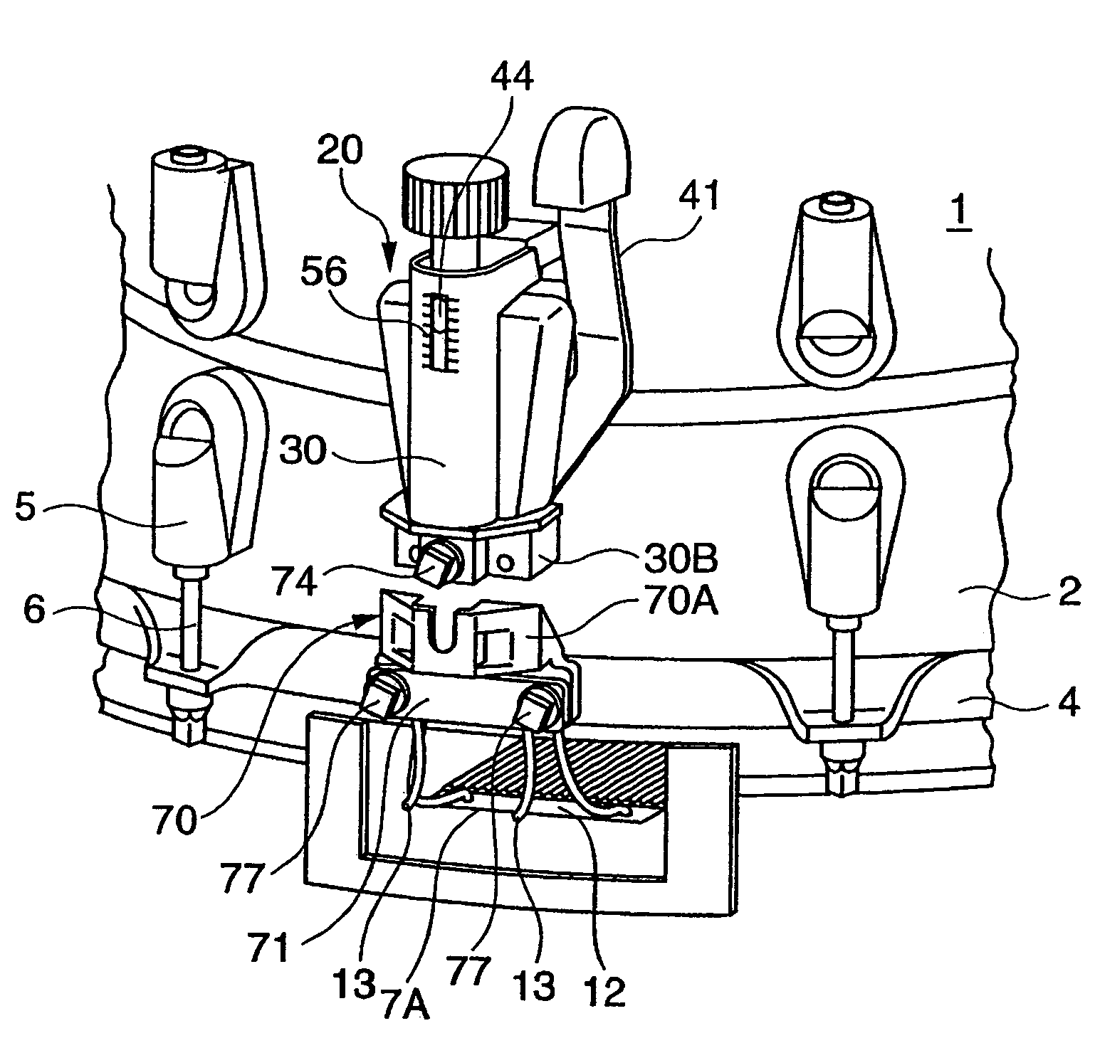 Snare strainer