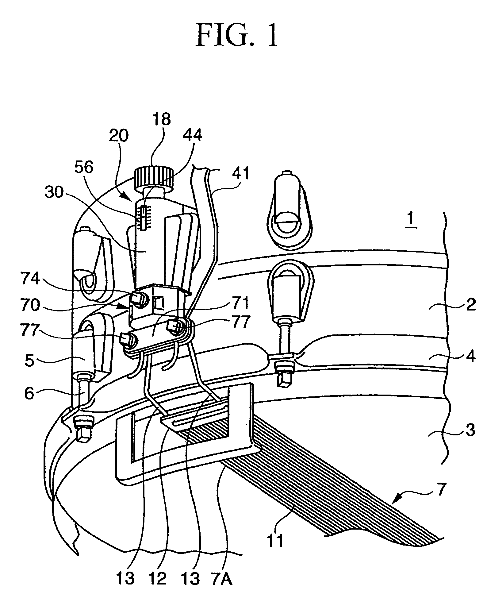 Snare strainer