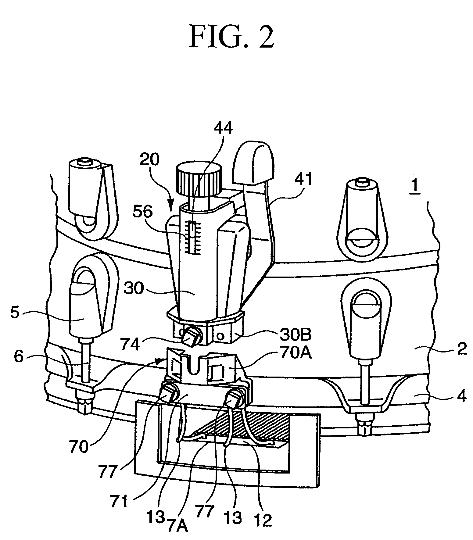 Snare strainer