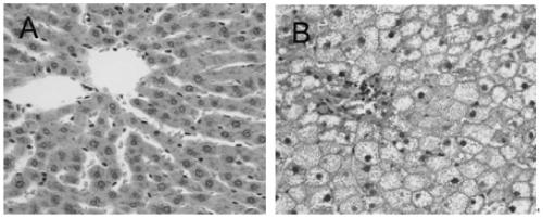 Application of aspartic acid in preparation of medicine for preventing and treating nonalcoholic fatty liver disease