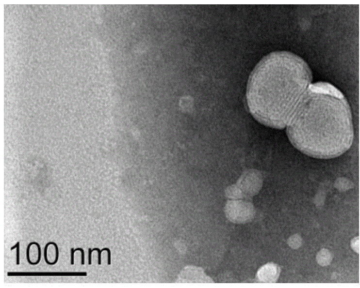 PH sensitive phospholipid molecule and preparation method as well as application thereof