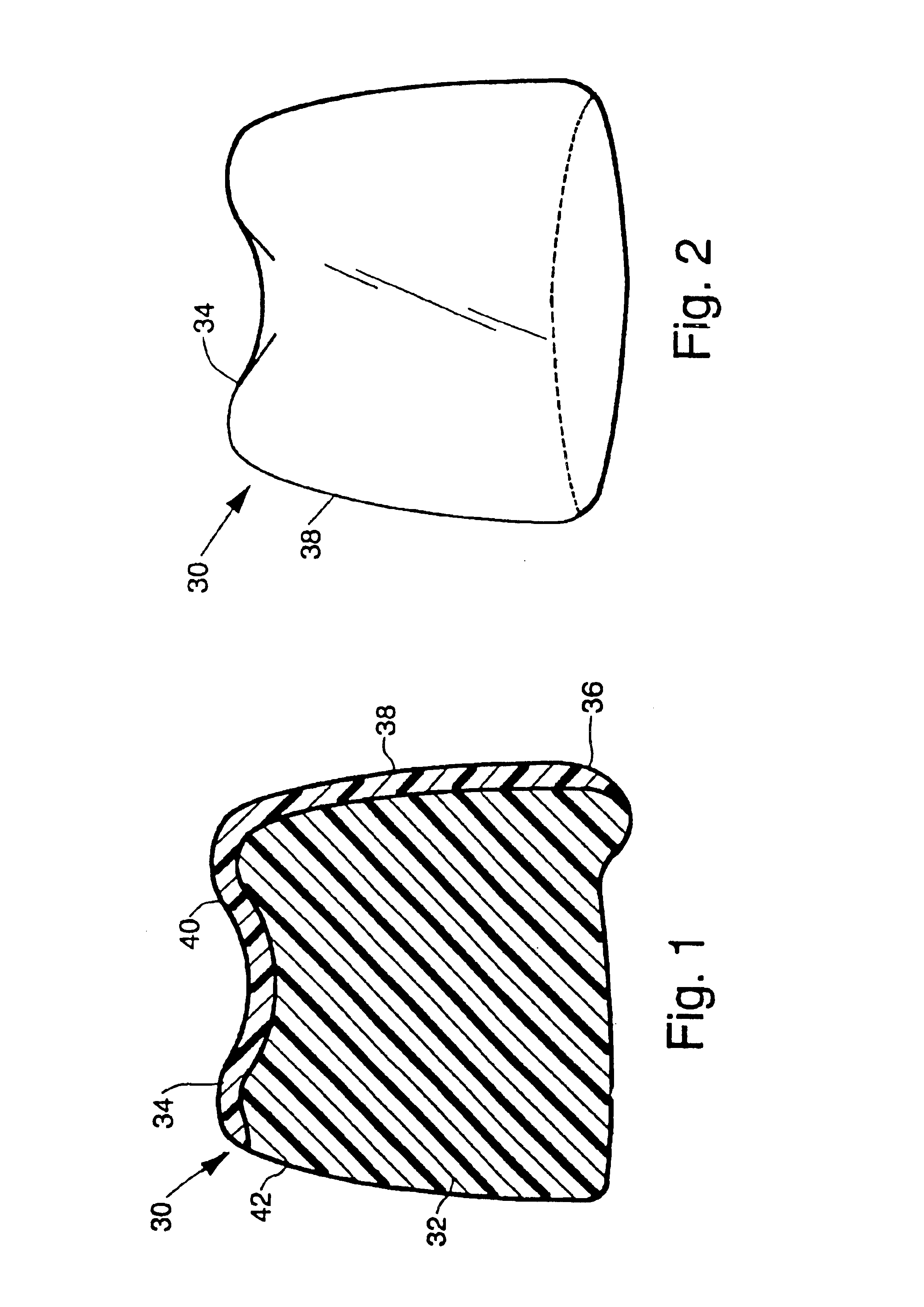 Dental prosthesis