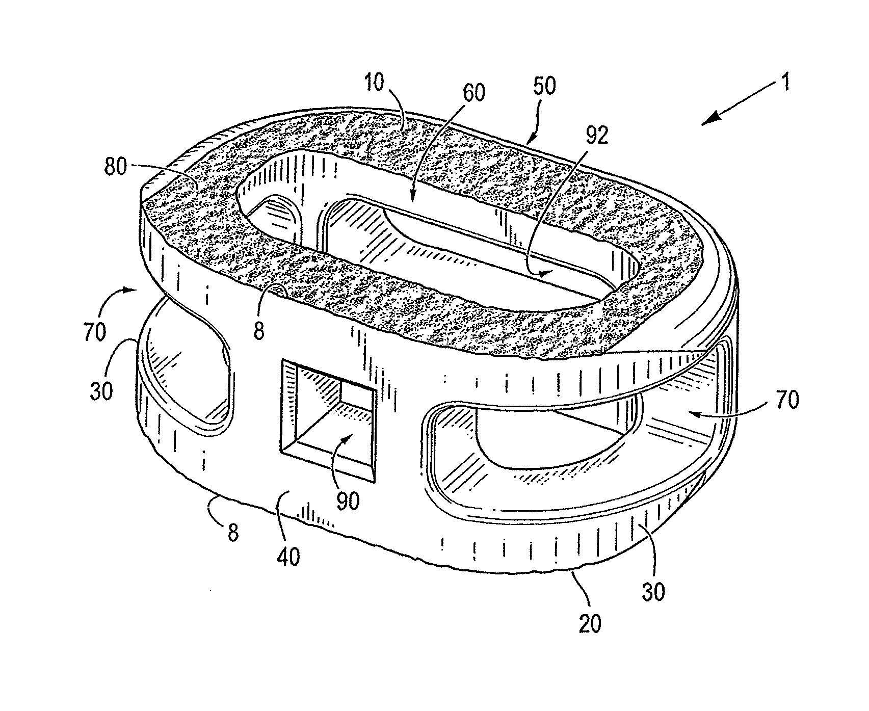 Spinal implant having a passage for enhancing contact between bone graft material and cortical endplate bone