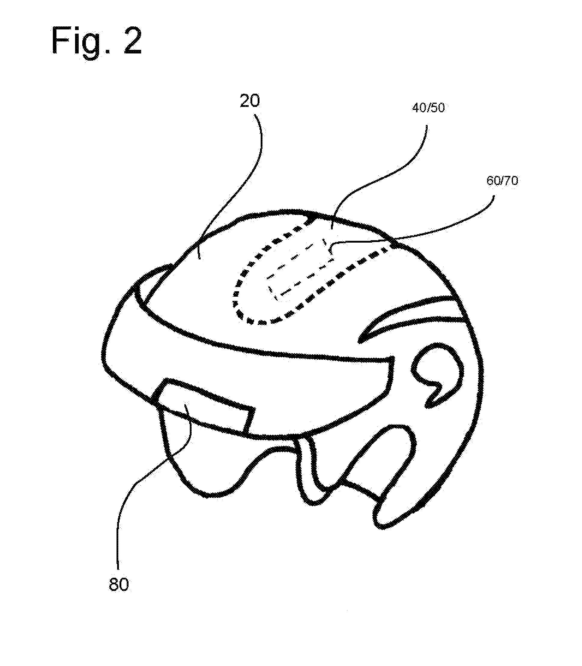 Helmet System