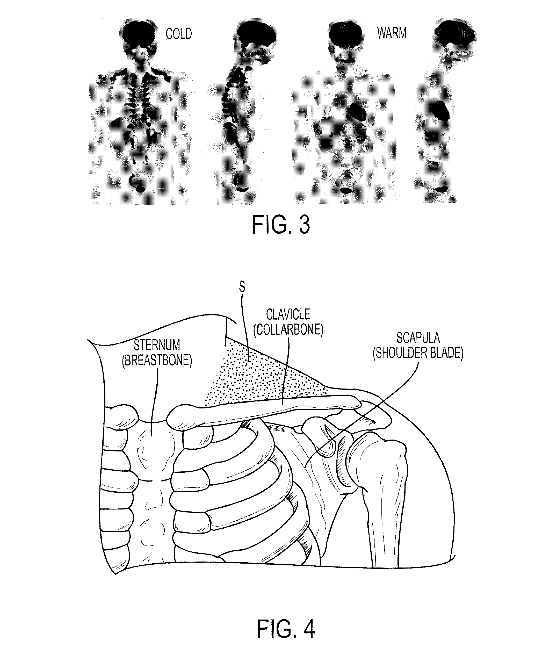 Methods and devices for activating brown apidose tissue using electrical energy