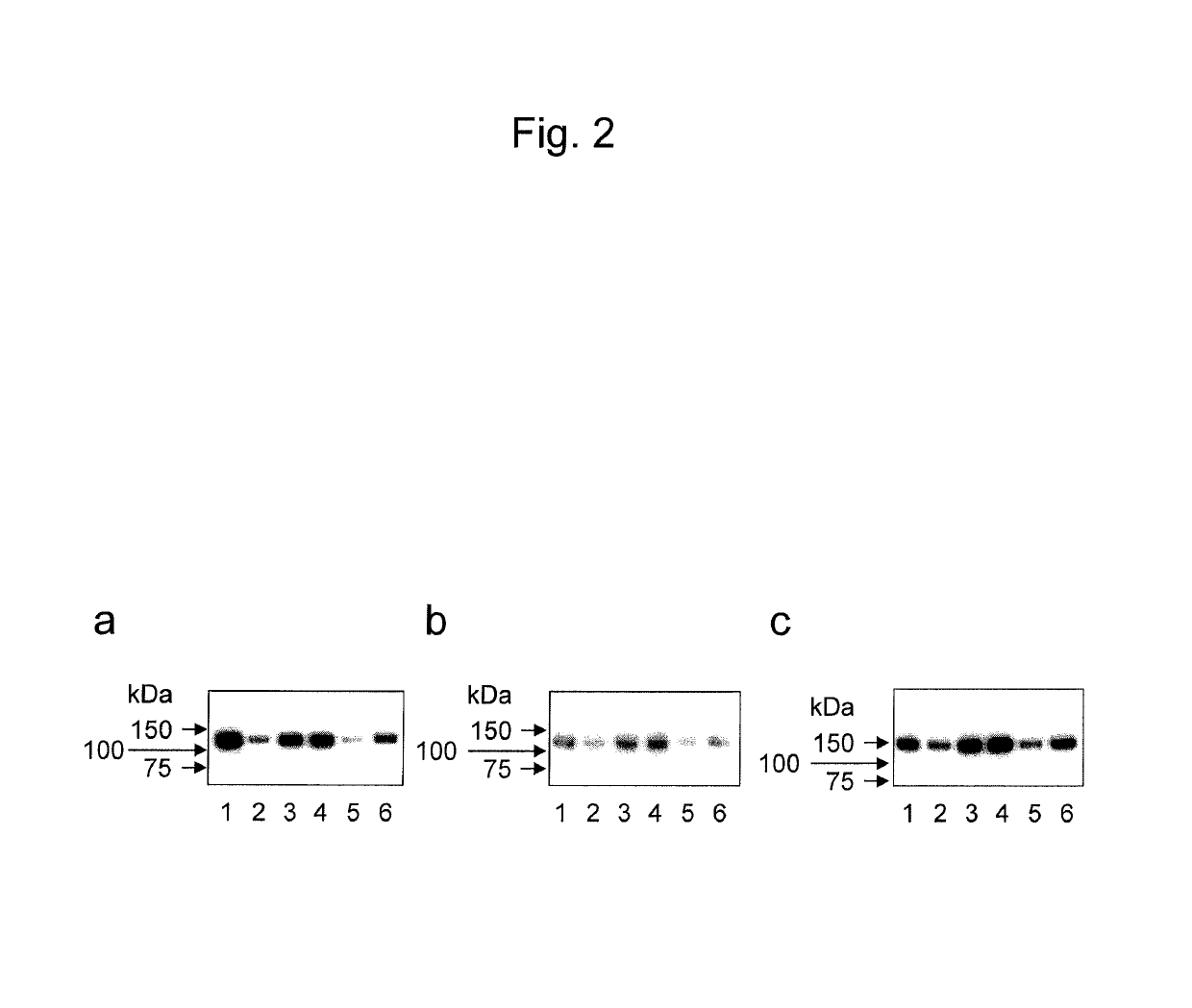 Antibody for detecting epithelial ovarian cancer marker and method for diagnosing epithelial ovarian cancer