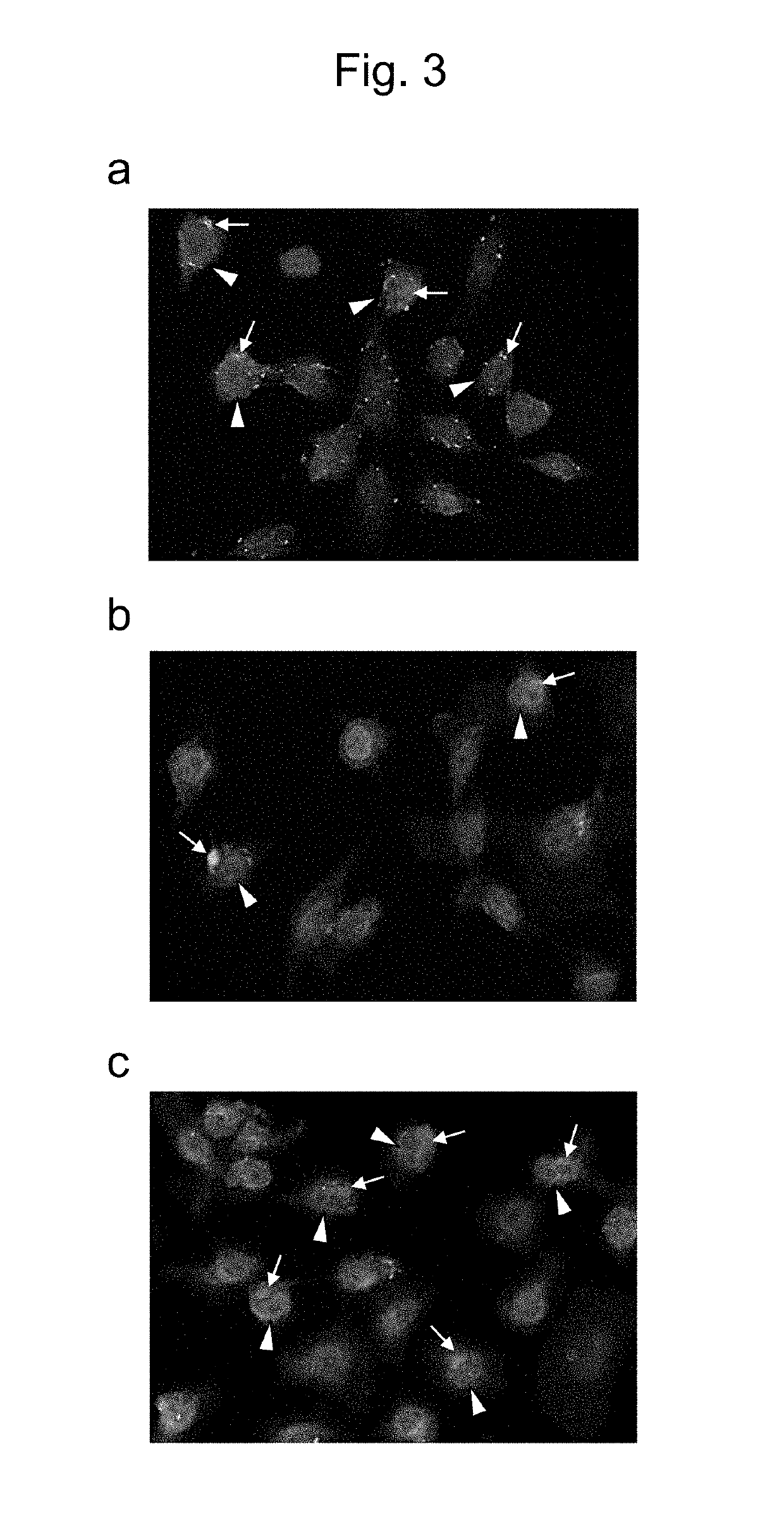 Antibody for detecting epithelial ovarian cancer marker and method for diagnosing epithelial ovarian cancer