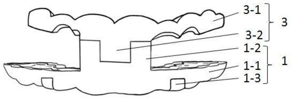 A kind of root tip operation guide plate and manufacturing method thereof