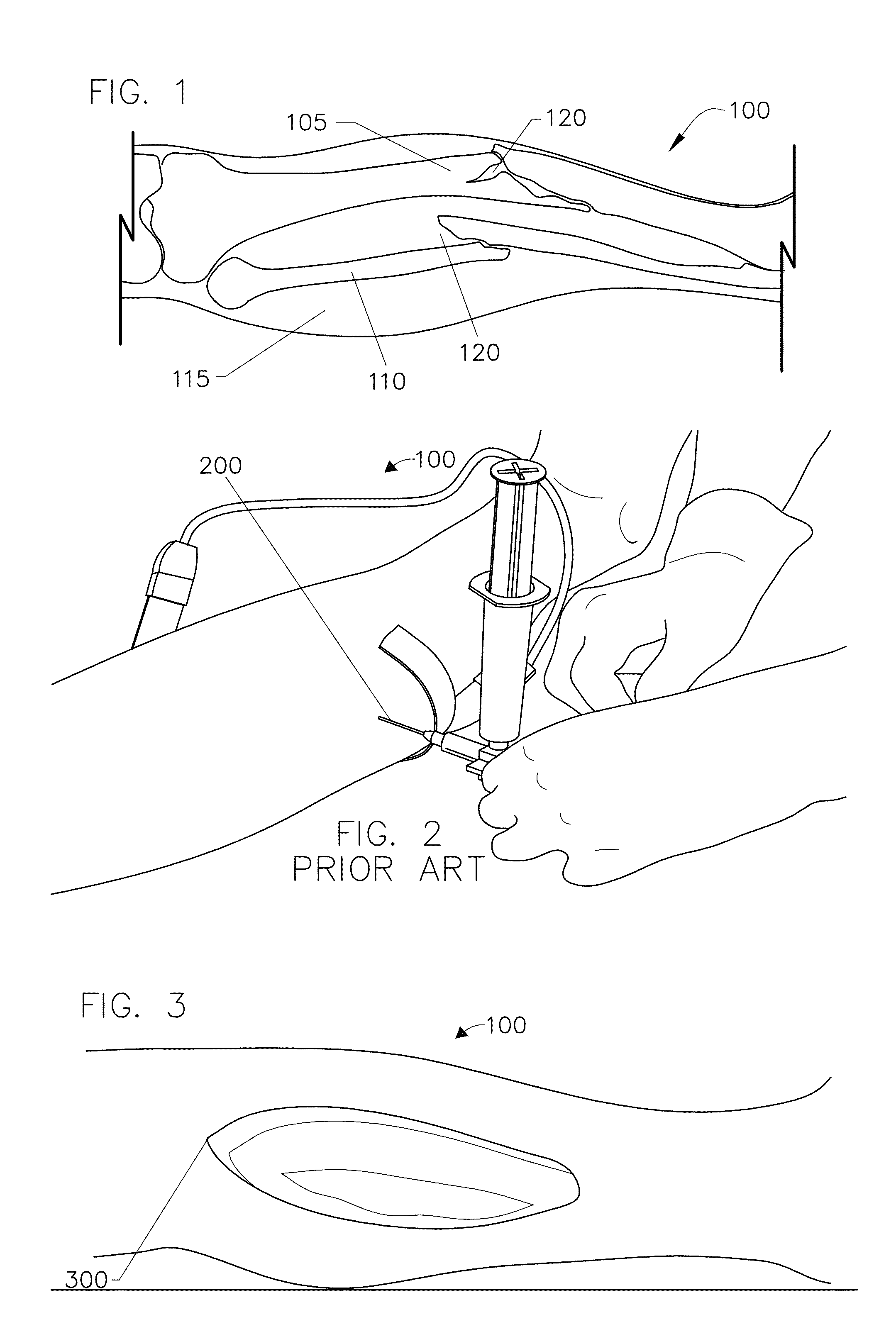 Method and system for providing versatile nirs sensors