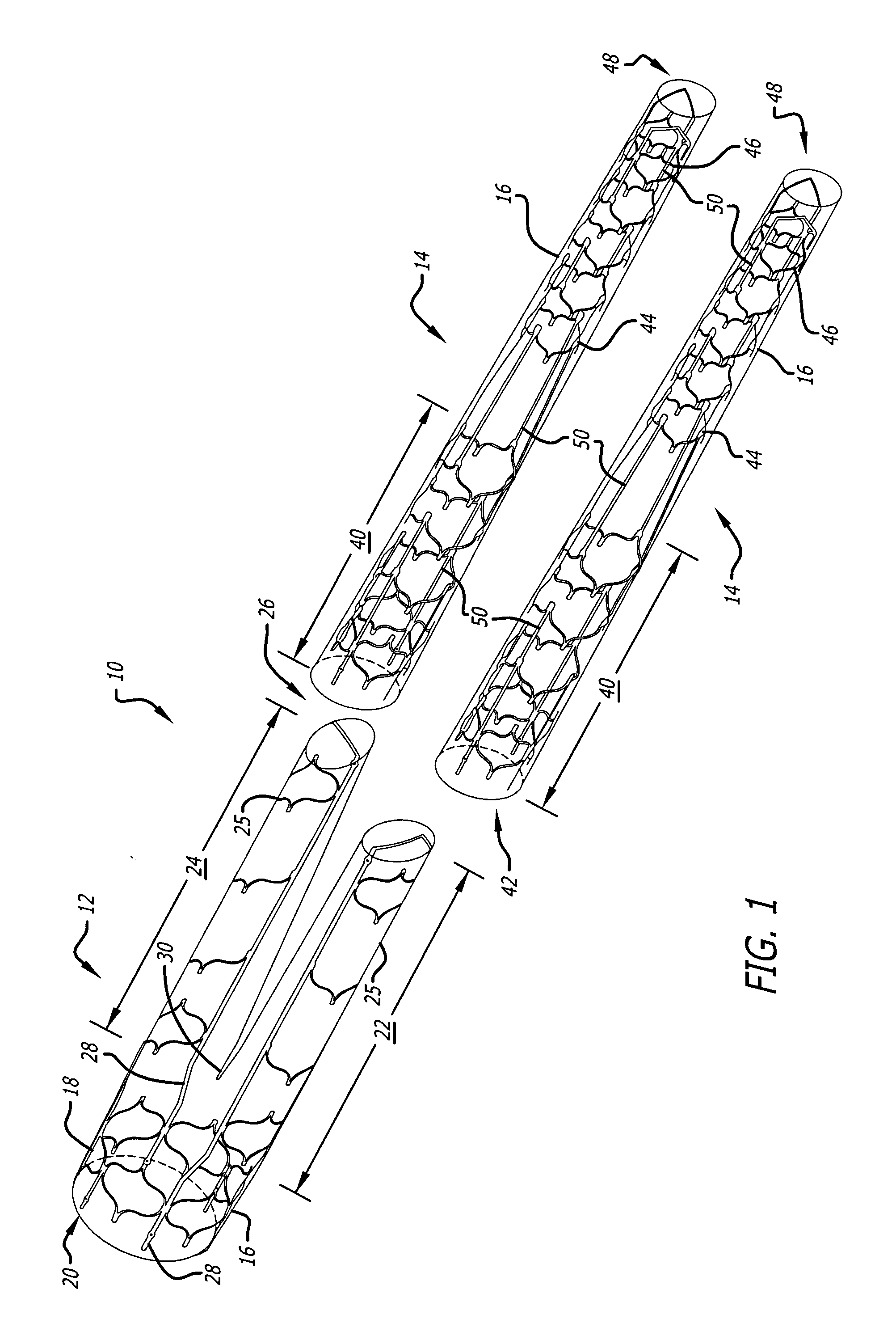 Universal length sizing and dock for modular bifurcated endovascular graft