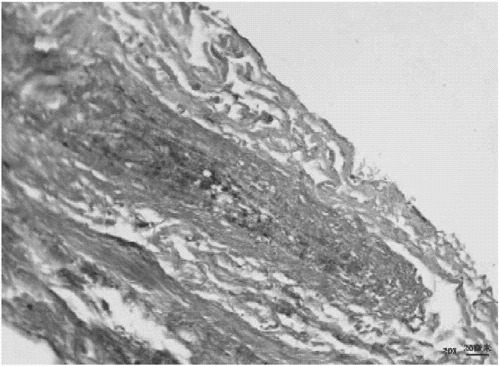 Biological tissue matrix material, and preparation method and purpose thereof