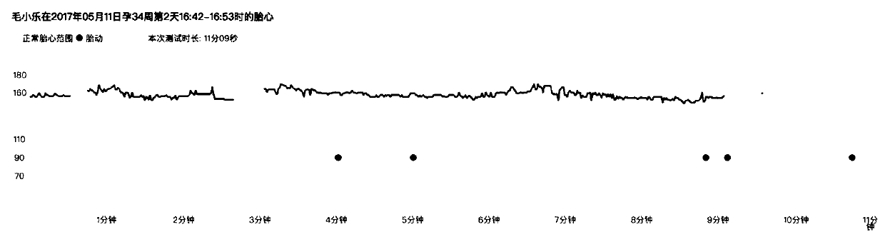 Method and system for drawing on user equipment based on fetal heart rate and fetal movement data