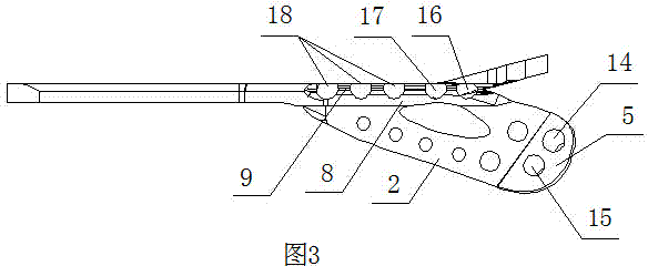 Intertrochanteric arc-shaped bone fracture plate