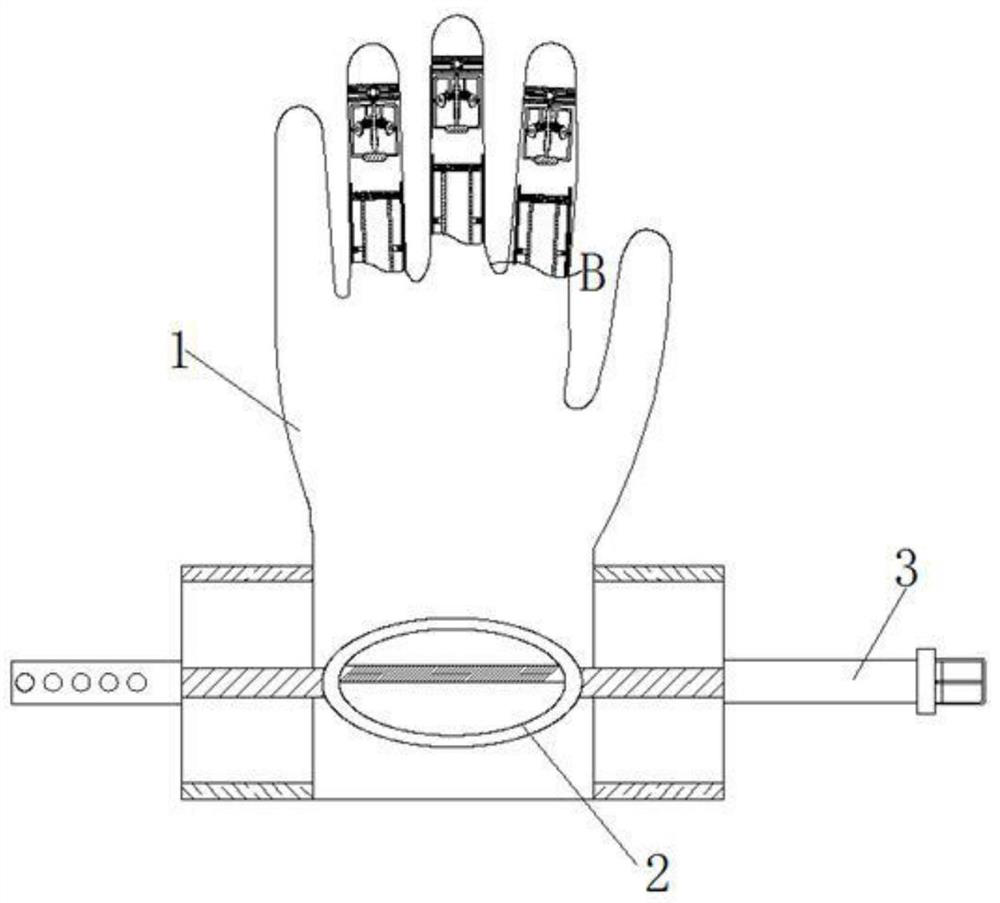 A Portable Hand Hemiplegia Rehabilitation Exercise Auxiliary Device