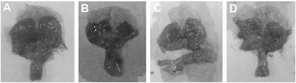 Application of pawpaw total triterpene and components thereof in pharmacy