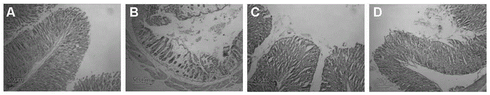 Application of pawpaw total triterpene and components thereof in pharmacy