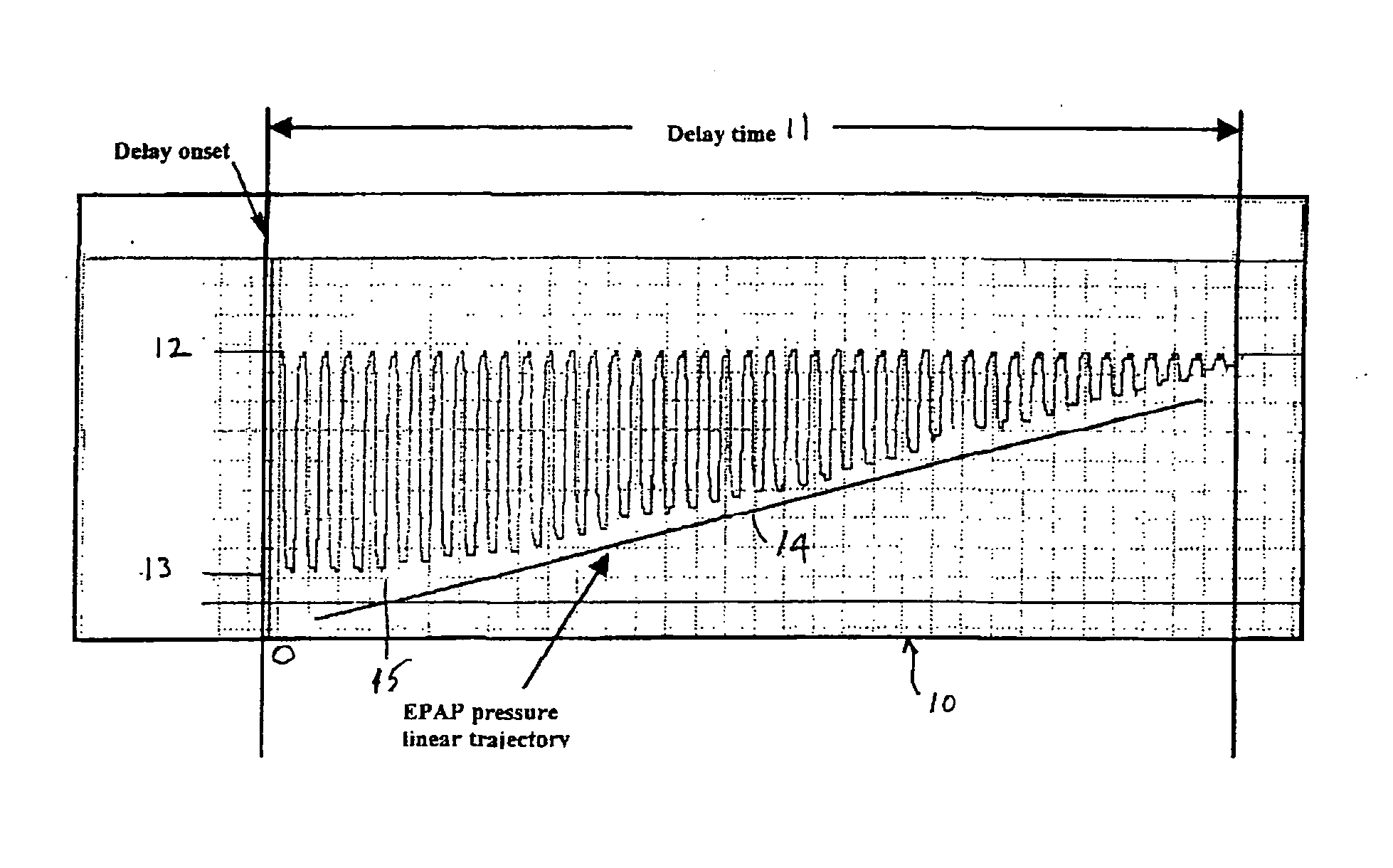 Method for acclimating a CPAP therapy patient to prescribed pressure