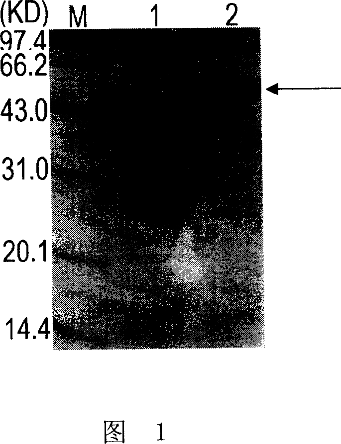 Enzyme linked immunoreaction reagent kit for detecting rabies virus