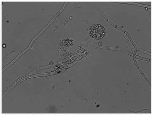 Monascus for high yield of saccharifying enzyme, esterifying enzyme and protease and isolated culture method and application thereof