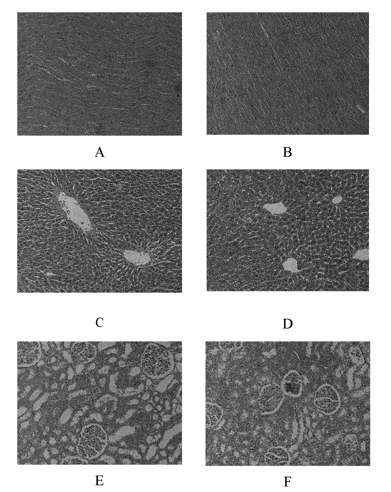 Hydrogel dressing containing recombinant human epidermal growth factor and preparation method and application thereof