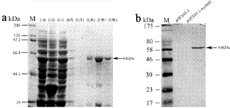 Method for catalytically synthesizing scopolamine and recombinant bacterial strain