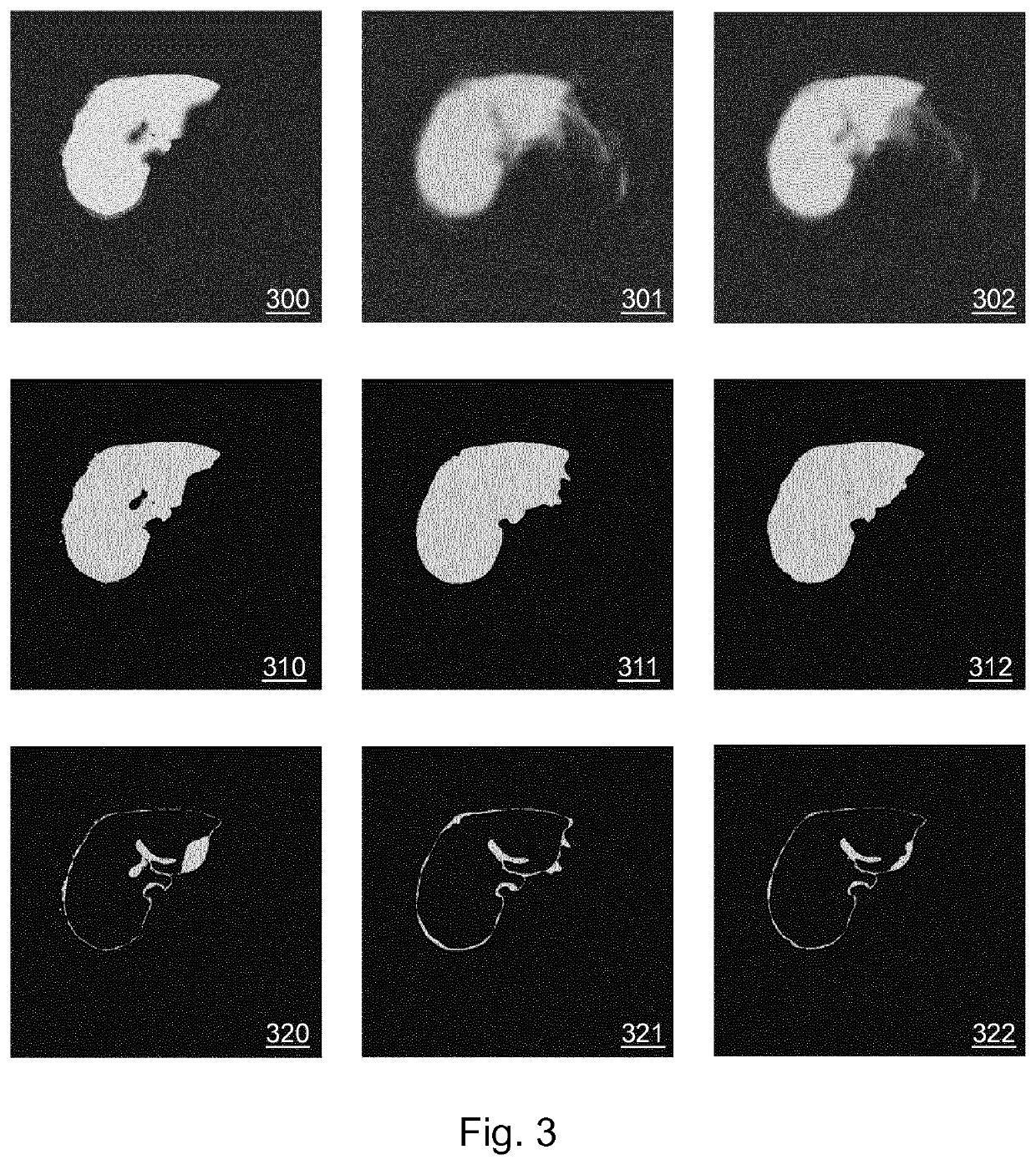 Interactive iterative image annotation