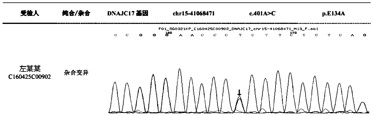 Autosomal dominant Dnajc17 gene mutant as well as application, diagnostic kit and diagnostic gene chip thereof