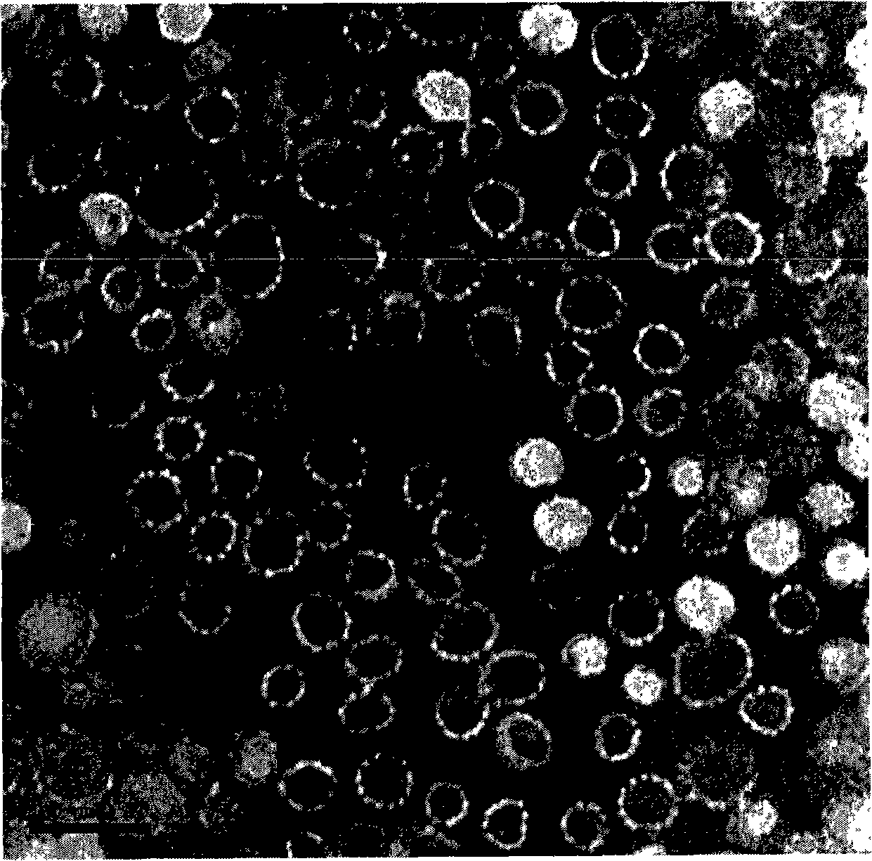 Truncated human papilloma virus 18 type L1 protein