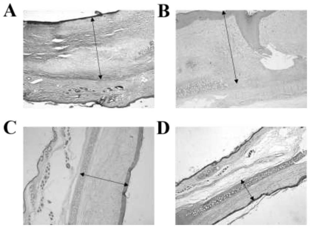 Inverse opal membrane for inhibiting scar generation and preparation method thereof