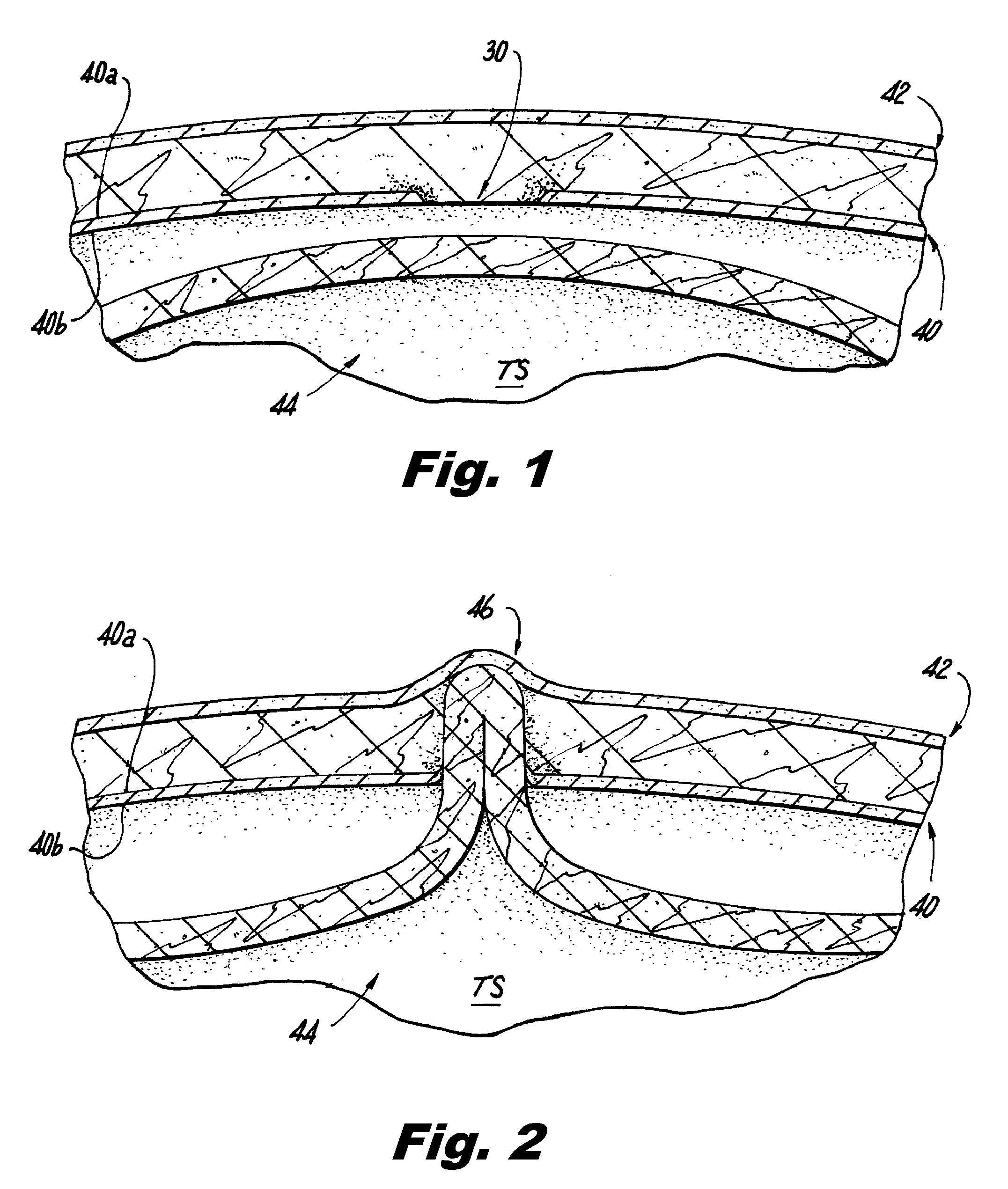 Methods of using light to repair hernia defects