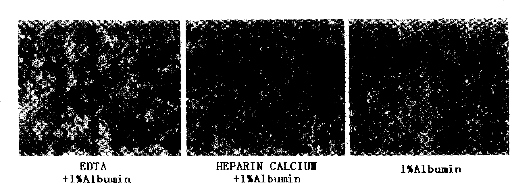 Mesenchyme stem cell preserving fluid and use thereof