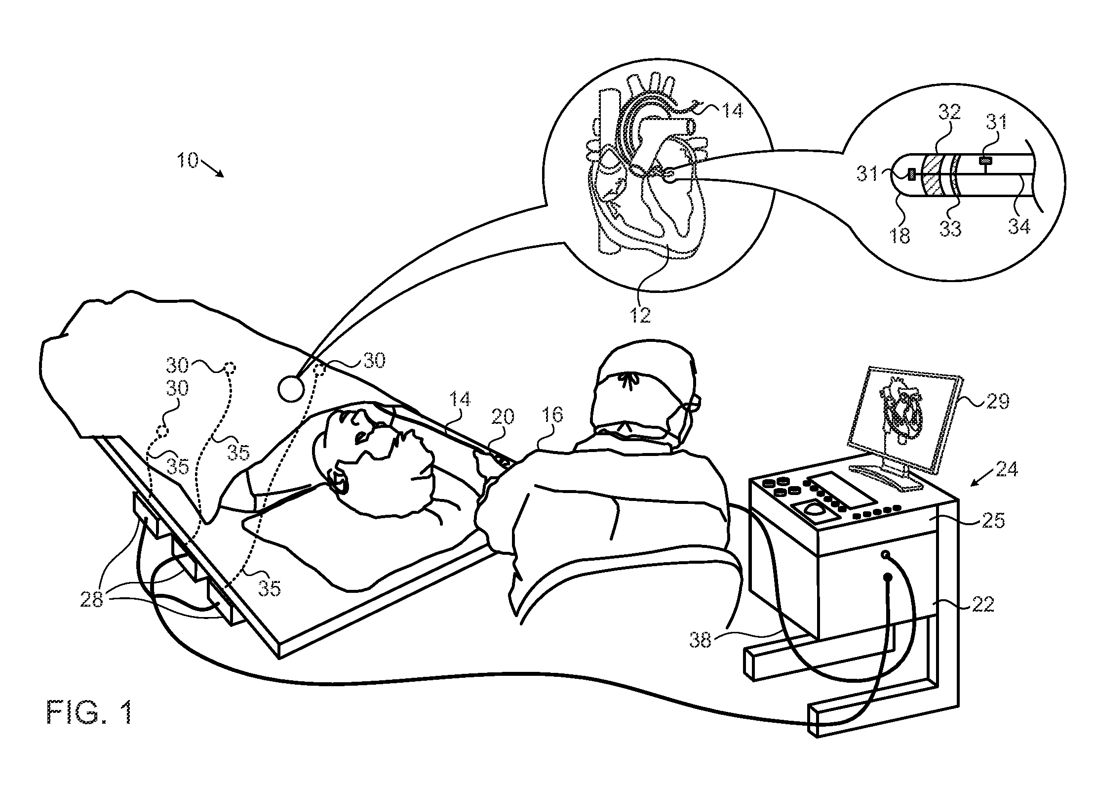 Using catheter position and temperature measurement to detect movement from ablation point