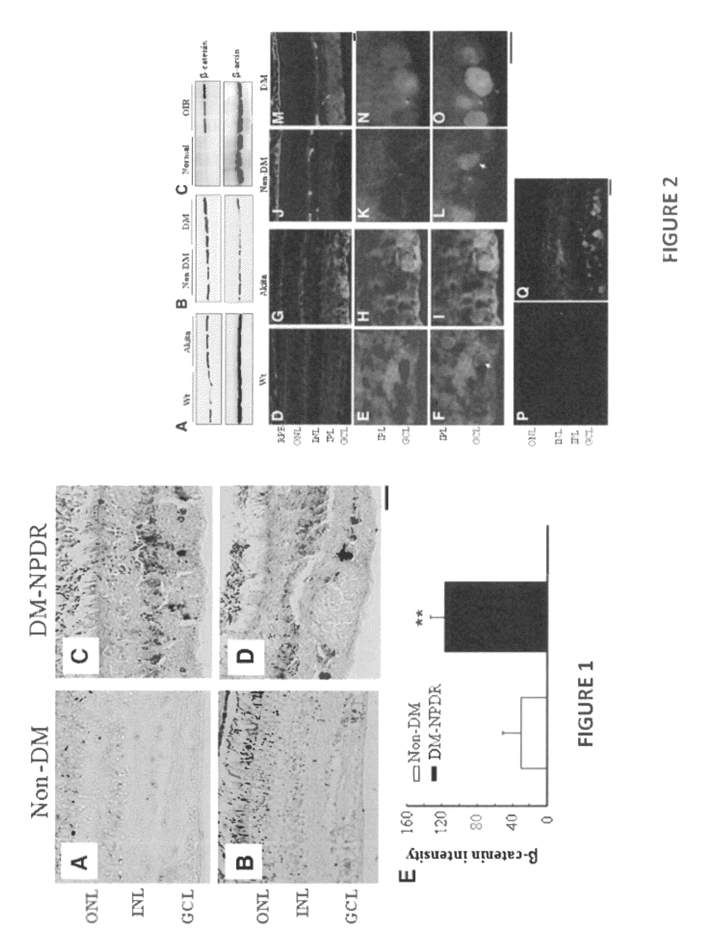 Monoclonal antibodies that inhibit the wnt signaling pathway and methods of production and use thereof