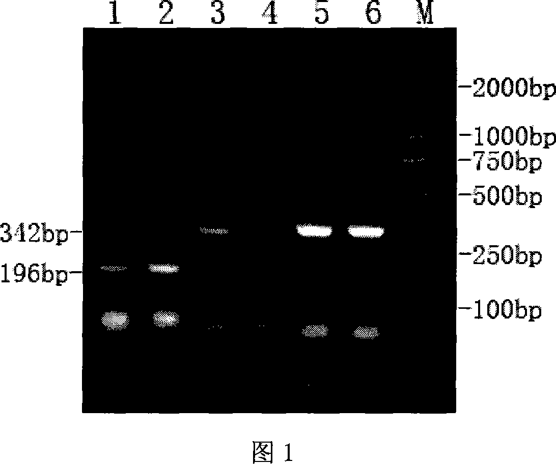 Dual RT-PCR method and special reagent case for checking cattle rotavirus and cattle virus diarrhea virus simultaneously