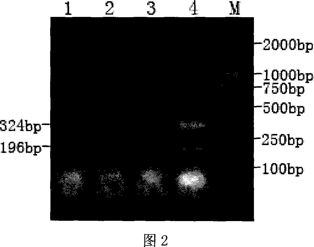 Dual RT-PCR method and special reagent case for checking cattle rotavirus and cattle virus diarrhea virus simultaneously