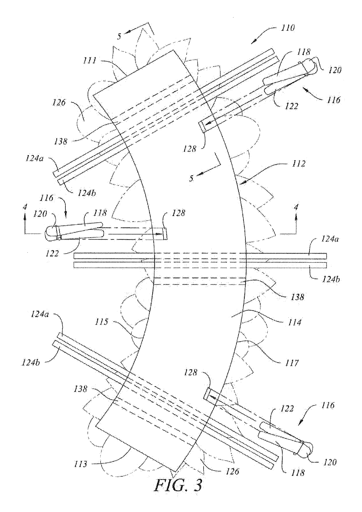 Universal Wreath Decoration System