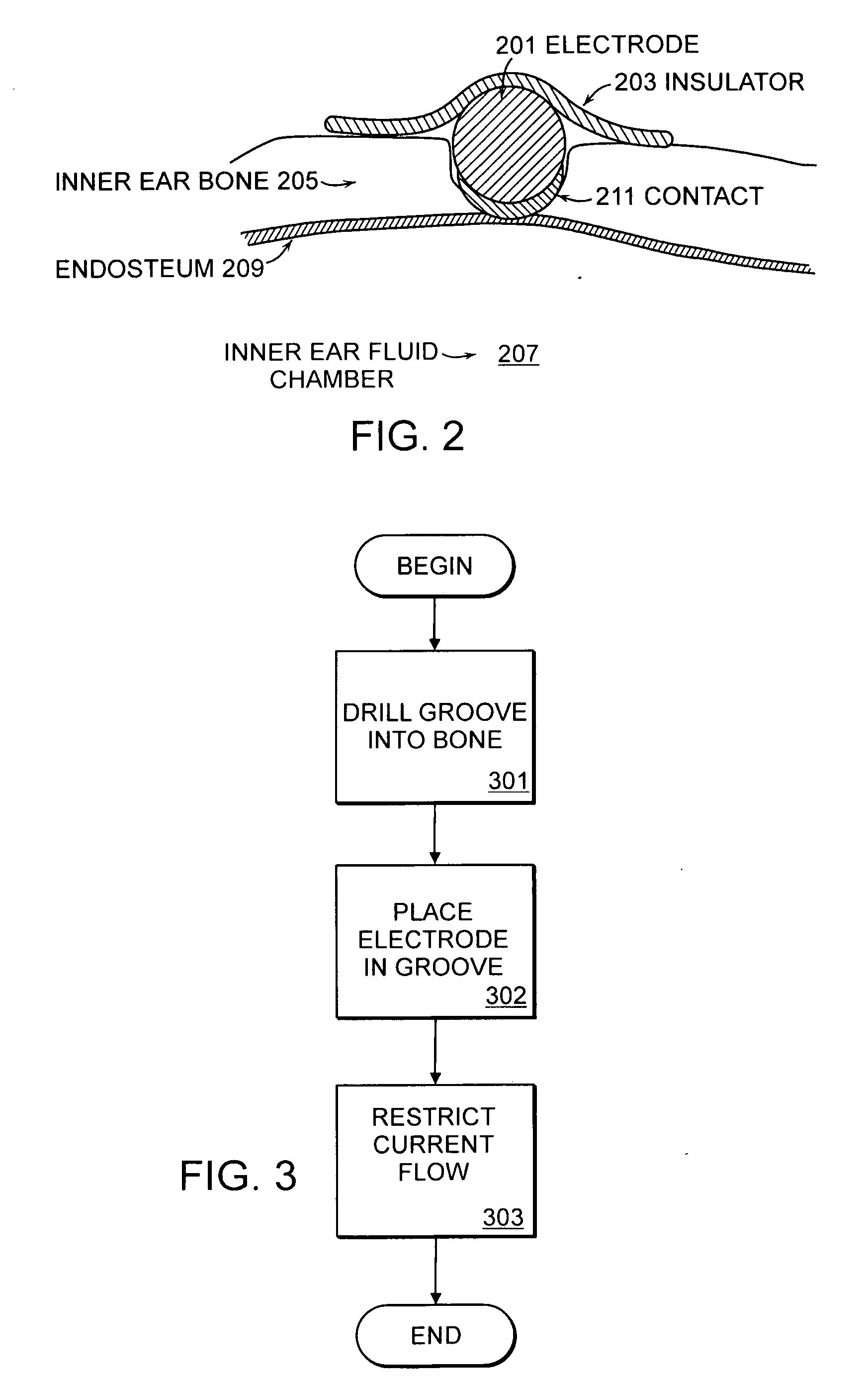 Middle ear multi-channel electrode